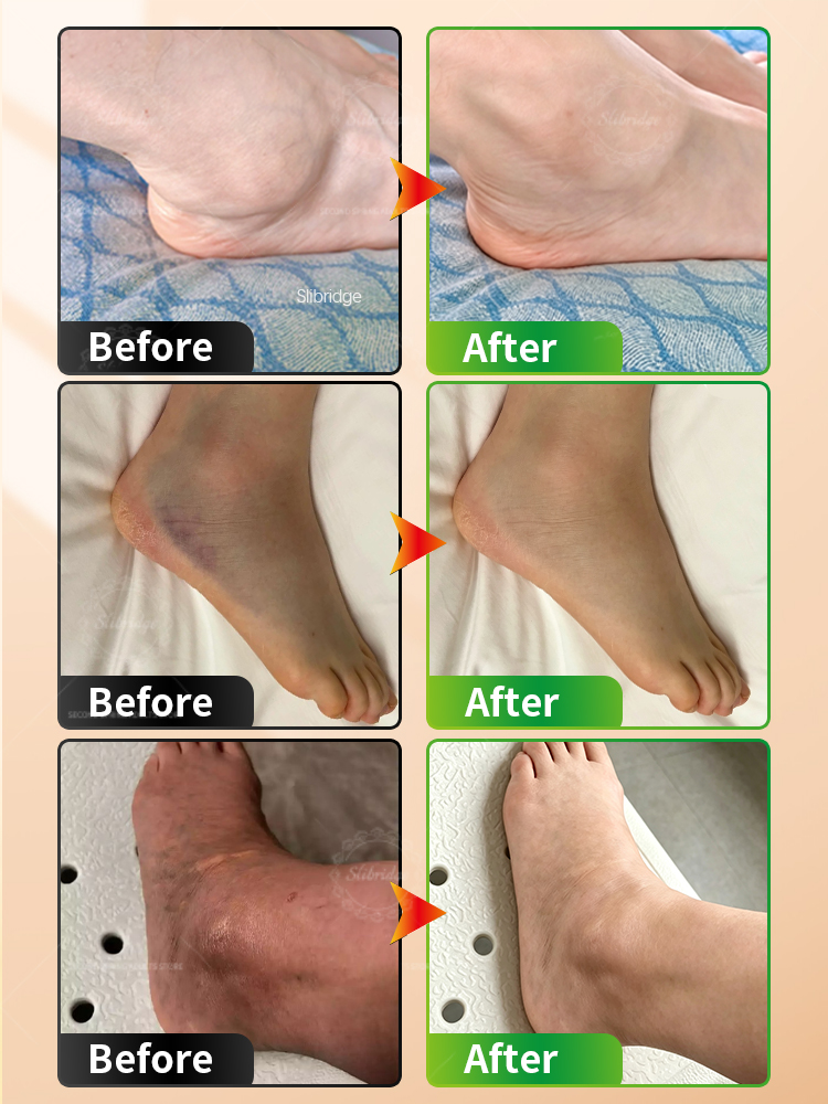 Portable Heated Ankle Massager - Ankle Brace Support recension och pris